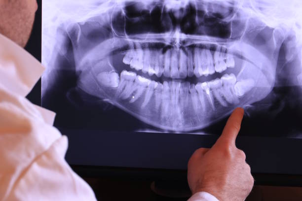 Best Dental Abscess Treatment in La Huerta, NM